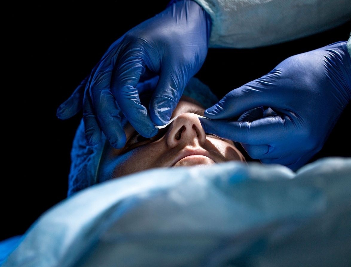 ניתוח פלסטי ללא הסכמה: כ- 216,000 ₪ פיצוי בשל פגיעה באוטונומיה